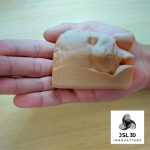 3D scanned real fetus with G.E. Voluson E8 Ultrasound